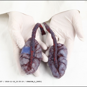 malatsion, "Genese/genesen, treatment sheet for ID_016MRX  at stage 9", 2016-2017